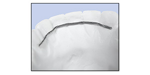 Spooled Dead Soft Ligature Wire - US Orthodontic Products